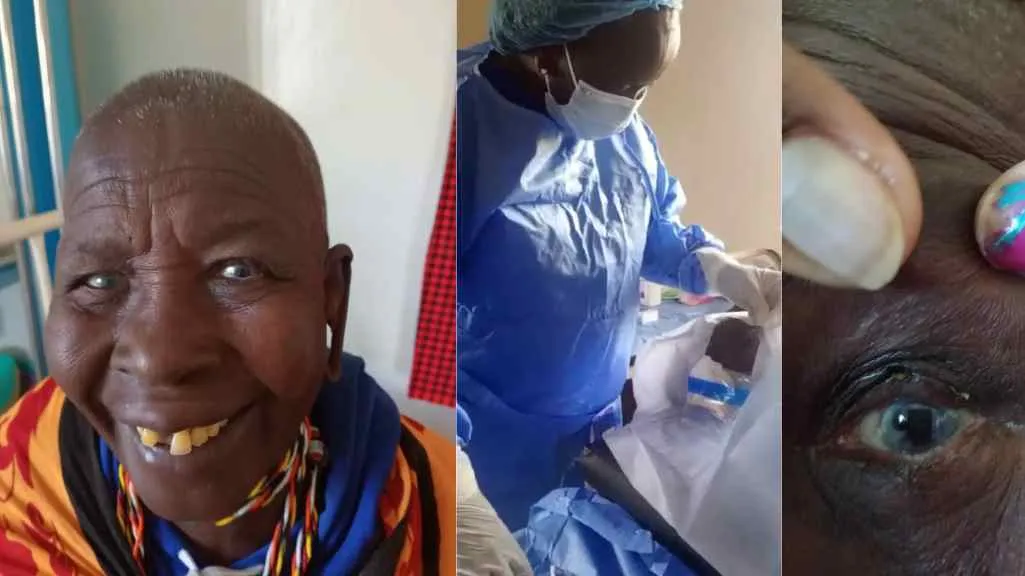 Images showing Napolo&rsquo;s journey through trachoma trichiasis surgery. The first shows her smiling after surgery